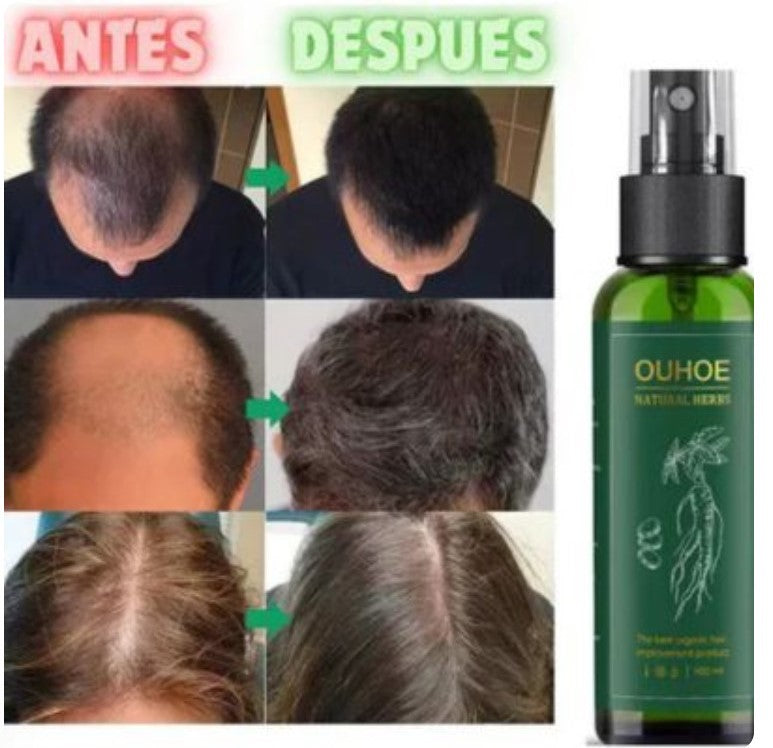 SPRAY OUHOE Activa el crecimiento desde la raíz con FollicX