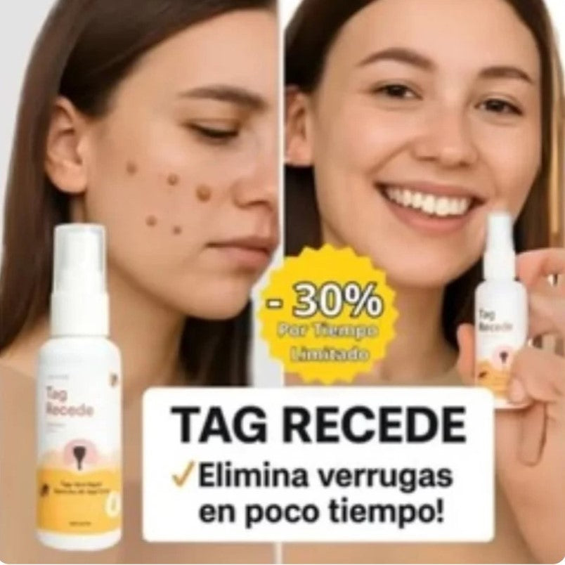 ¡TAG RECEDE! Eliminador de verrugas