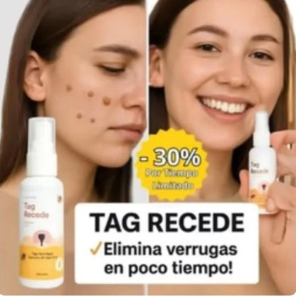 ¡TAG RECEDE! Eliminador de verrugas
