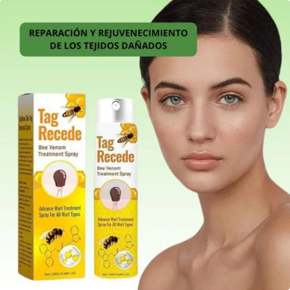 ¡TAG RECEDE! Eliminador de verrugas