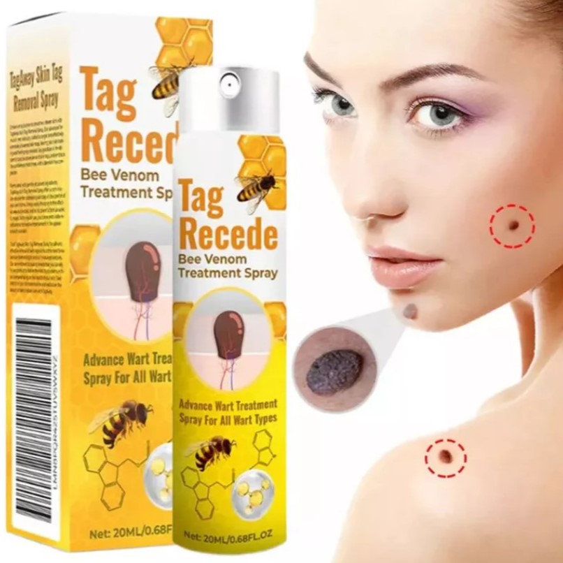 ¡TAG RECEDE! Eliminador de verrugas