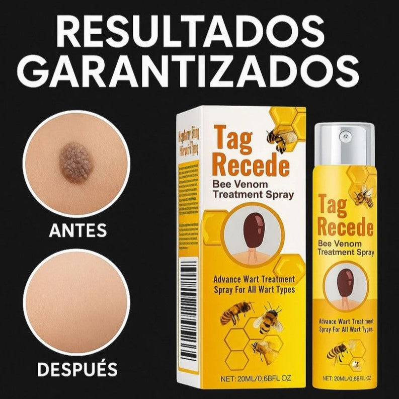 ¡TAG RECEDE! Eliminador de verrugas