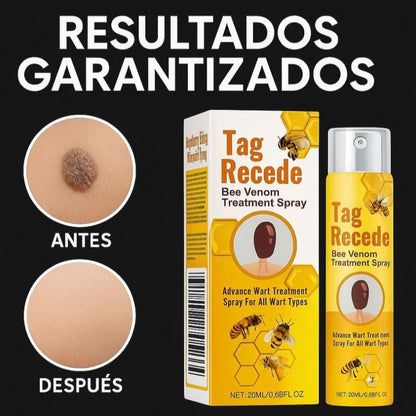 ¡TAG RECEDE! Eliminador de verrugas