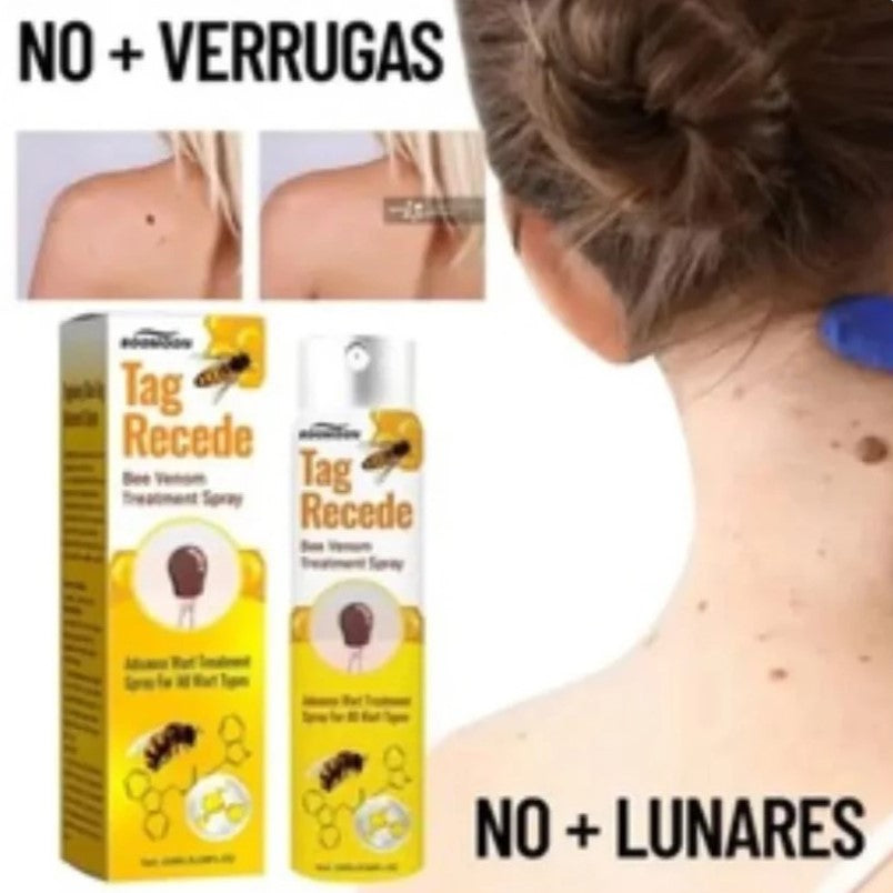 ¡TAG RECEDE! Eliminador de verrugas